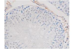 ABIN6267487 at 1/200 staining Rat testis tissue sections by IHC-P.
