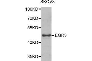 Western blot analysis of extracts of SKOV3 cells, using EGR3 antibody.