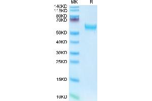 Mouse IL-18RAP on Tris-Bis PAGE under reduced condition. (IL18RAP Protein (AA 20-356) (His tag))