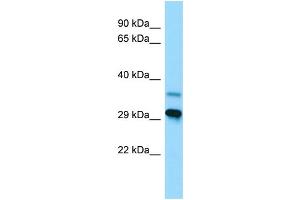 WB Suggested Anti-LYPLAL1 Antibody Titration: 1.