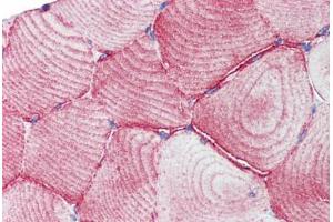 Human Skeletal Muscle (formalin-fixed, paraffin-embedded) stained with TEAD1 antibody ABIN462220 followed by biotinylated goat anti-rabbit IgG secondary antibody ABIN481713, alkaline phosphatase-streptavidin and chromogen. (TEAD1 antibody  (C-Term))