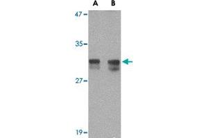 Western blot analysis of RASD2 in rat colon tissue lysate with RASD2 polyclonal antibody  at (A) 1 and (B) 2 ug/mL . (RASD2 antibody  (N-Term))