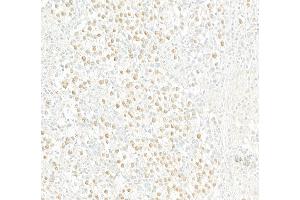 Immunohistochemistry (IHC) image for anti-Androgen Receptor (AR) (AA 1-50) antibody (ABIN7454995)