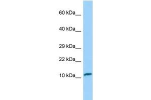 Western Blotting (WB) image for anti-Fast Skeletal Troponin C (TNNC2) (N-Term) antibody (ABIN2790315) (TNNC2 antibody  (N-Term))