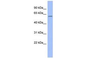 Image no. 1 for anti-Calcium Channel, Voltage-Dependent, beta 1 Subunit (CACNB1) (AA 395-444) antibody (ABIN6742588)