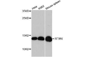 Western blot analysis of extracts of various cell lines, using SF3B6 antibody (ABIN6290152) at 1:3000 dilution.