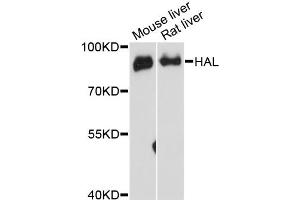 Western blot analysis of extracts of various cell lines, using HAL antibody (ABIN6292128) at 1:3000 dilution. (HAL antibody)
