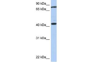 WB Suggested Anti-TEX9 Antibody Titration: 0. (TEX9 antibody  (Middle Region))