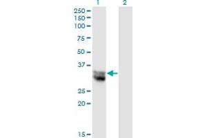 Western Blot analysis of NIT1 expression in transfected 293T cell line by NIT1 monoclonal antibody (M01), clone 1C3.