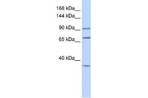 EEF2 antibody used at 1 ug/ml to detect target protein. (EEF2 antibody  (N-Term))