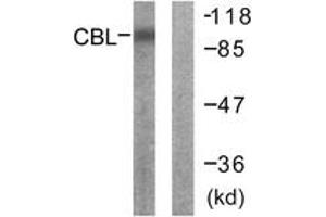 Western Blotting (WB) image for anti-Cas-Br-M (Murine) Ecotropic Retroviral Transforming Sequence (CBL) (AA 666-715) antibody (ABIN2888651) (CBL antibody  (AA 666-715))