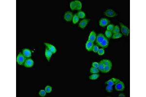 Immunofluorescent analysis of PC-3 cells using ABIN7170309 at dilution of 1:100 and Alexa Fluor 488-congugated AffiniPure Goat Anti-Rabbit IgG(H+L) (SSTR2 antibody  (AA 304-369))