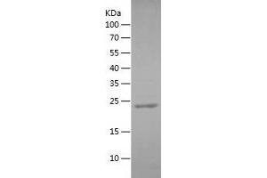 Western Blotting (WB) image for Armadillo Repeat Containing, X-Linked 3 (ARMCX3) (AA 175-379) protein (His tag) (ABIN7282809) (ARMCX3 Protein (AA 175-379) (His tag))