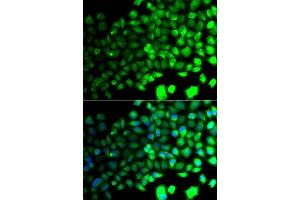 Immunofluorescence analysis of A549 cells using PRKAA2 antibody. (PRKAA2 antibody  (AA 343-552))