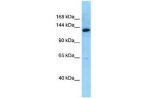 Image no. 1 for anti-MN1 proto-oncogene (MN1) (AA 1249-1298) antibody (ABIN6748132)