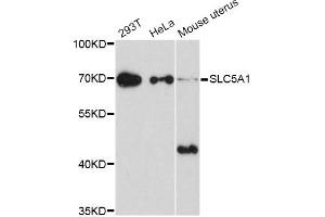 Western blot analysis of extracts of various cell lines, using SLC5A1 Antibody (ABIN5998870) at 1/1000 dilution. (SLC5A1 antibody)