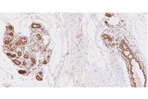 Immunohistochemistry (IHC) image for anti-Ubiquitin-Conjugating Enzyme E2L 6 (UBE2L6) (AA 1-152), (N-Term) antibody (ABIN317574) (UBE2L6 antibody  (N-Term))