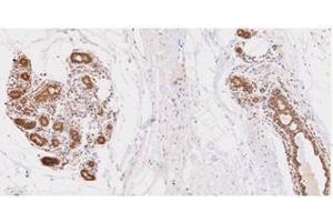 Immunohistochemistry (IHC) image for anti-Ubiquitin-Conjugating Enzyme E2L 6 (UBE2L6) (AA 1-152), (N-Term) antibody (ABIN317575) (UBE2L6 antibody  (N-Term))