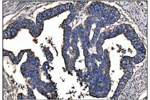 IHC analysis of Ornithine Aminotransferase/OAT using anti-Ornithine Aminotransferase/OAT antibody (ABIN7600649). (OAT antibody  (AA 214-439))