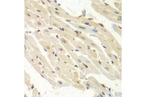 Immunohistochemistry of paraffin-embedded mouse heart using PSME1 antibody (ABIN1876546) at dilution of 1:100 (40x lens). (PSME1 antibody)