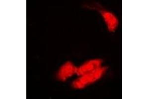 Immunofluorescent analysis of SULT2B1 staining in A549 cells. (SULT2B1 antibody)