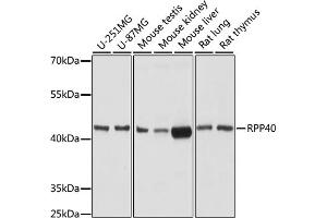 Western blot analysis of extracts of various cell lines, using RPP40 antibody (ABIN7269984) at 1:1000 dilution. (RPP40 antibody  (AA 130-210))
