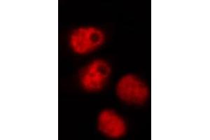 ABIN6268905 staining HeLa by IF/ICC. (OCT4 antibody  (Internal Region))