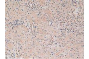 Figure. (MAP4 antibody  (AA 2-250))