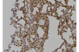 ABIN6268990 at 1/100 staining Mouse lung tissue by IHC-P. (PPP1R12A antibody  (C-Term))