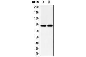 Western blot analysis of PKC delta (pY313) expression in HeLa (A), MCF7 Caylculin A-treated (B) whole cell lysates. (PKC delta antibody  (pTyr313))
