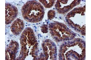 Immunohistochemical staining of paraffin-embedded Human breast tissue using anti-EPN2 mouse monoclonal antibody. (Epsin 2 antibody)