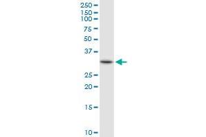 HADH MaxPab rabbit polyclonal antibody. (HADH antibody  (AA 1-314))
