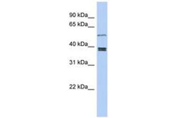 SS18L1 antibody  (AA 251-300)