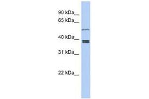 Image no. 1 for anti-Synovial Sarcoma Translocation Gene On Chromosome 18-Like 1 (SS18L1) (AA 251-300) antibody (ABIN6743926) (SS18L1 antibody  (AA 251-300))
