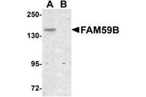 Western blot analysis of FAM59B in SK-N-SH cell lysate with AP30331PU-N FAM59B antibody at 1 μg/ml in (A) the absence and (B) the presence of blocking peptide. (FAM59B antibody  (C-Term))