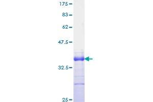 JAG1 Protein (AA 531-620) (GST tag)