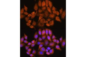 Immunofluorescence analysis of HeLa cells using  Rabbit pAb (ABIN7269965) at dilution of 1:100. (ARHGAP30 antibody  (AA 485-585))