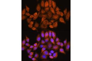 Immunofluorescence analysis of HeLa cells using  Rabbit pAb (ABIN7269965) at dilution of 1:100. (ARHGAP30 antibody  (AA 485-585))
