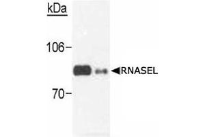 Western blot analysis of RNASEL in transfected cells (0. (RNASEL antibody)