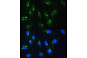 Immunofluorescence analysis of H9C2 cells using NBAS Rabbit pAb (ABIN1680973, ABIN3019188, ABIN3019189 and ABIN6220752) at dilution of 1:100.