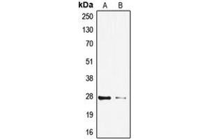 Western blot analysis of TP53INP1 expression in HeLa (A), HepG2 (B) whole cell lysates.