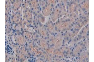 Immunohistochemistry (IHC) image for anti-Integrin beta 3 (ITGB3) (AA 134-376) antibody (ABIN7439249)