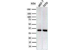 Western Blot Analysis of Human MCF-7, T47D cell lysates using RPA2 Recombinant Rabbit Monoclonal Antibody (RPA2/3140R). (Recombinant RPA2 antibody)