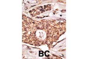 Formalin-fixed and paraffin-embedded human lymph with ICOS Antibody (C-term), which was peroxidase-conjugated to the secondary antibody, followed by DAB staining. (ICOS antibody  (C-Term))