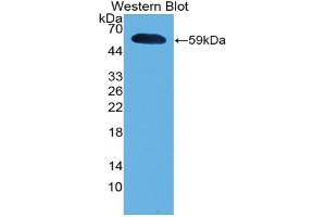 Western blot analysis of the recombinant protein. (IFNA5 antibody  (AA 22-189))