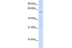 WB Suggested Anti-C16orf71 Antibody Titration: 0. (C16ORF71 antibody  (Middle Region))
