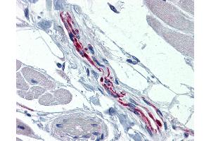 Anti-TH / Tyrosine Hydroxylase antibody IHC of human heart, nerve.