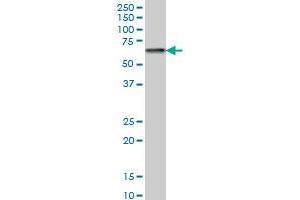 CACNB2 monoclonal antibody (M05), clone 6C4 Western Blot analysis of CACNB2 expression in Hela S3 NE . (CACNB2 antibody  (AA 213-301))