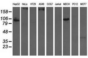 Image no. 3 for anti-Aldehyde Dehydrogenase 1 Family, Member L1 (ALDH1L1) antibody (ABIN1496585) (ALDH1L1 antibody)