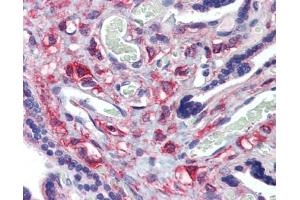 KIF20A antibody was used for immunohistochemistry at a concentration of 4-8 ug/ml. (KIF20A antibody  (Middle Region))